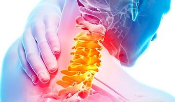 Servikal omurganın osteokondroz belirtileri