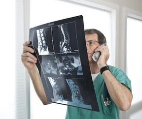 Osteokondroz ve intervertebral fıtık tanısı için miyelografi